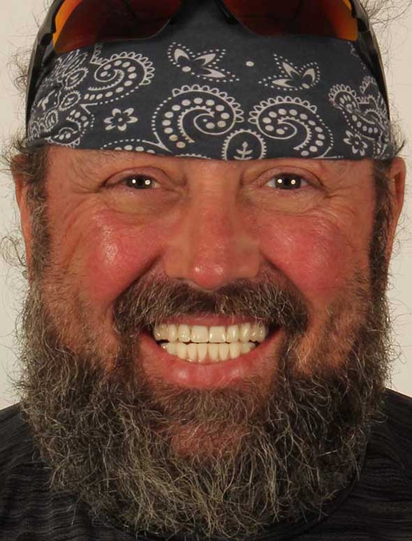 Dental implants replaced several front teeth resulting in a perfect smile.